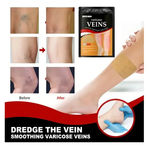 PARCHES CONTRA VARICES 2X1 -  24 PARCHES